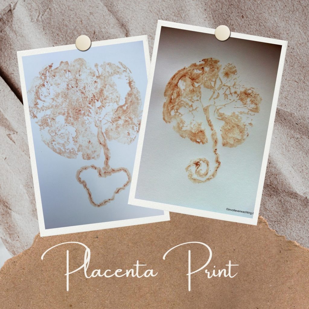 Placenta print